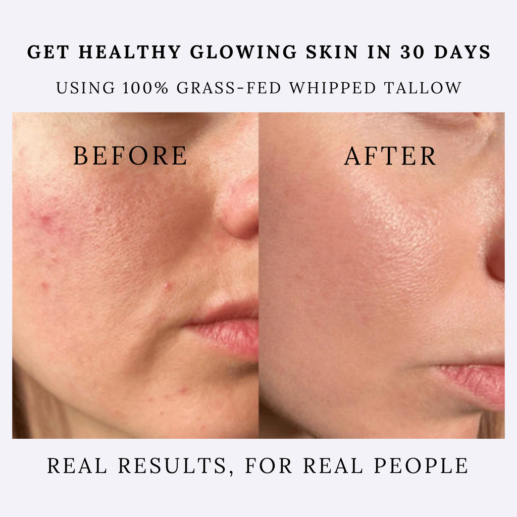 all natural organic face moisturizer 100% grass-fed beef tallow cream