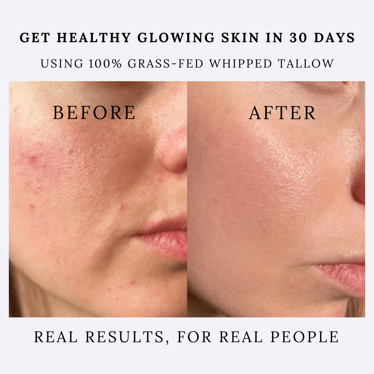 all natural organic face moisturizer 100% grass-fed beef tallow cream